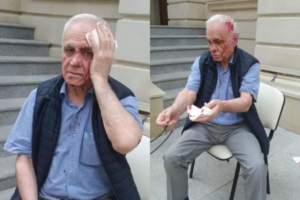 Rəhim Qazıyevin başını yaran görün           KİM İMİŞ